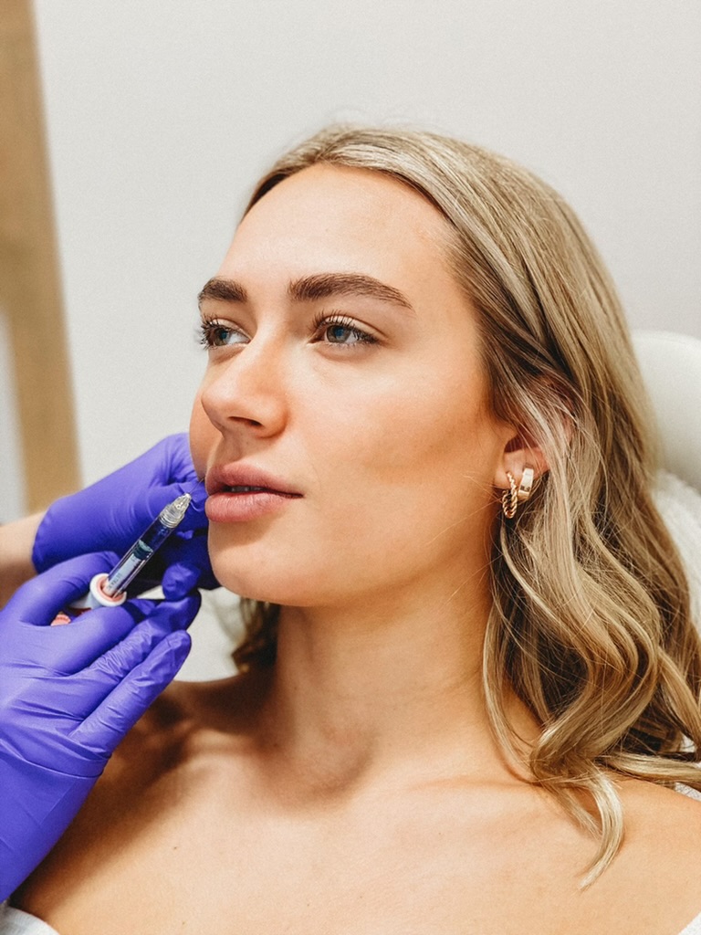 Lip Filler & Dermal Fillers Blur Aesthetic Madison & Middleton WI