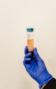 PRP Platelet-Rich Plasma