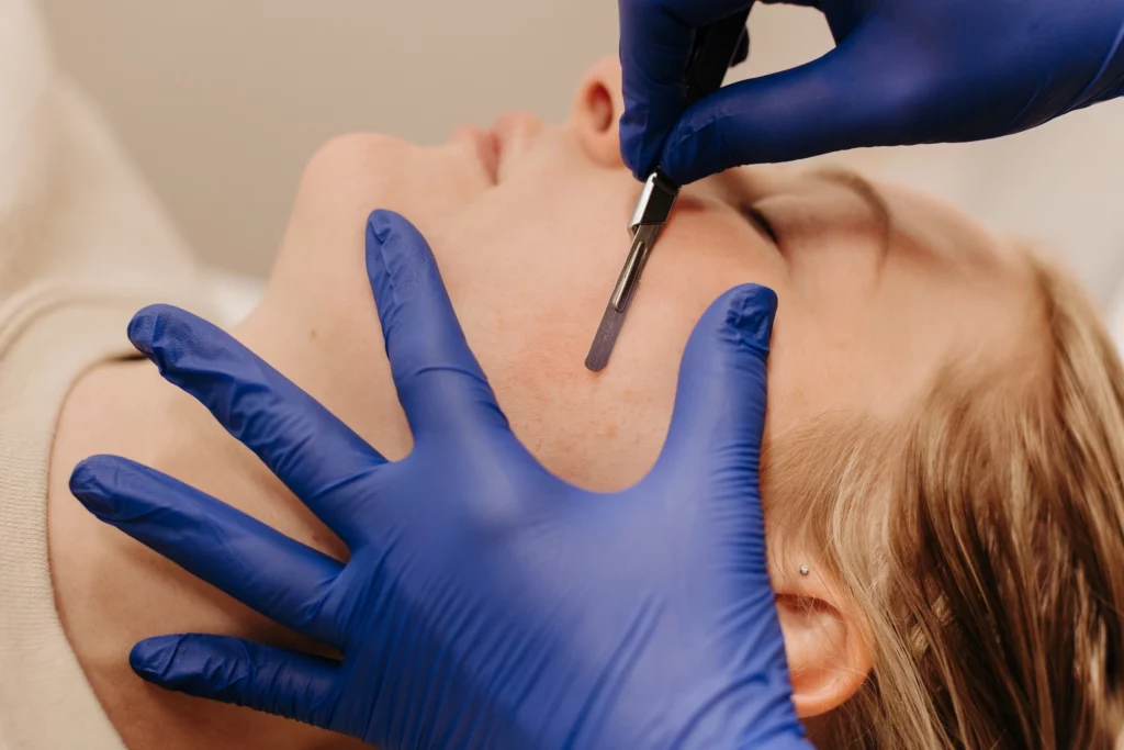 Dermaplaning Madison Wi Blur Med Spa Gallery 5