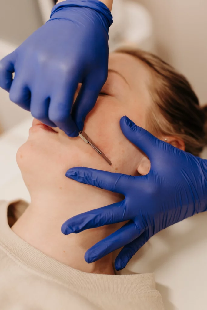 Dermaplaning Treatment Madison Wi Medical Spa Gallery 1